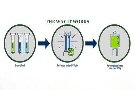 Ultraviolet Blood Irradiation Therapy – Soma Wellness Clinic