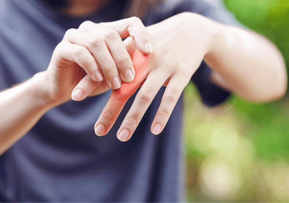 Rheumatoid Arthritis